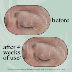 Calm & Renew Melting Eye Balm -Stralend Schoon xwTFqe1027251 4 global